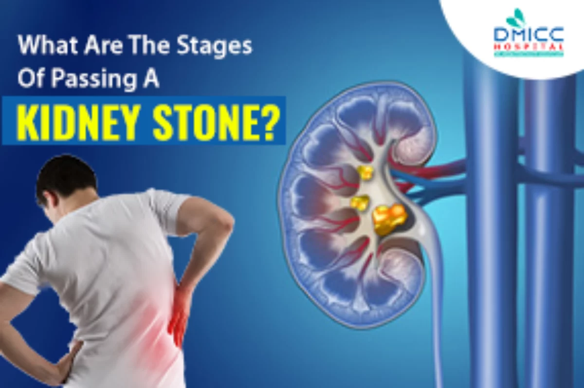 What Are The Stages Of Passing A Kidney Stone Dmicc
